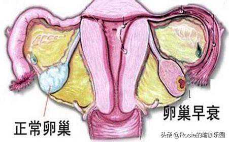 香港孕妇验血不能超过多久,熬夜对备孕会有影响吗？做试管的夫妇注意了