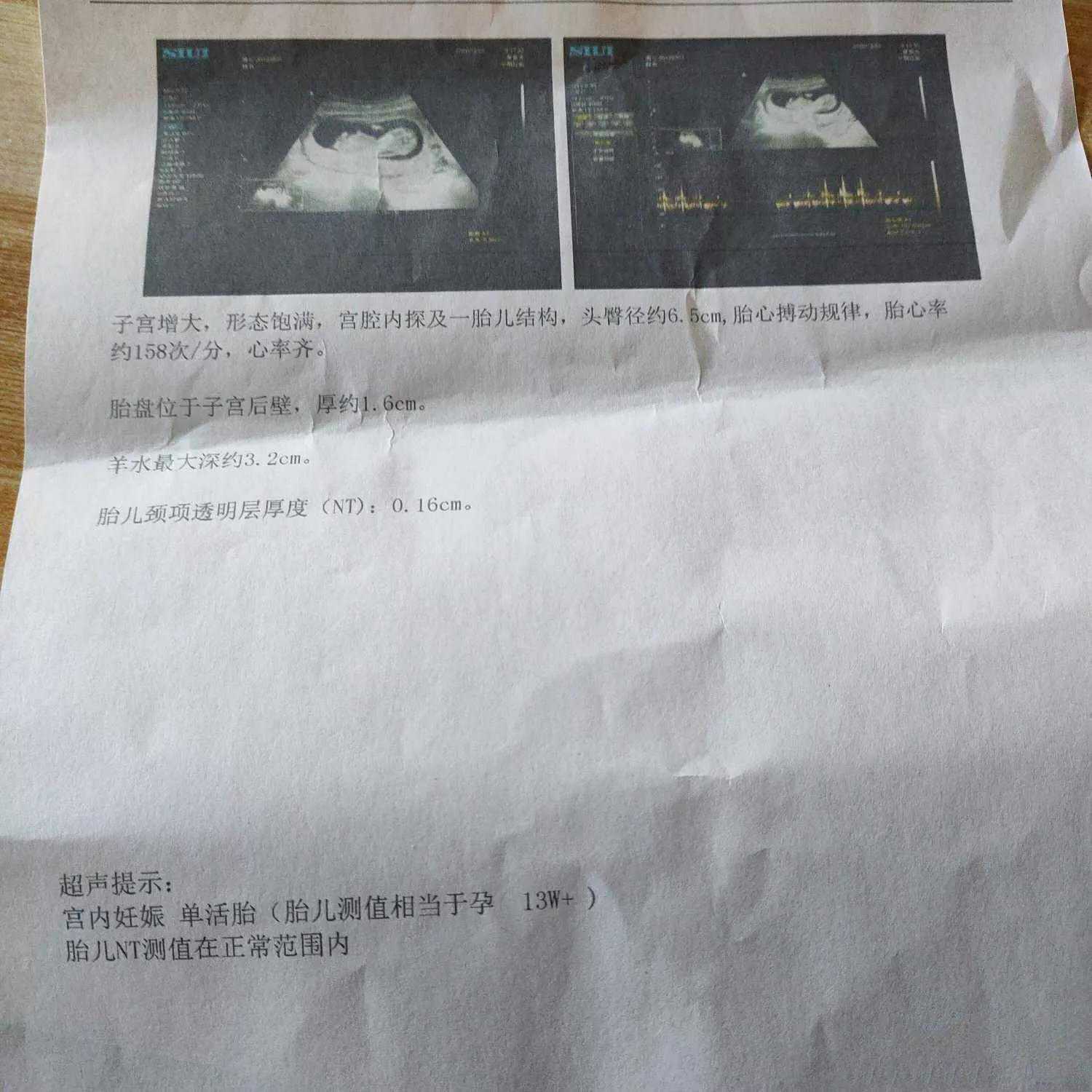 香港验血怎样瞒过快递,【金贝供卵】备孕一年后做输卵管造影，术前检查和过