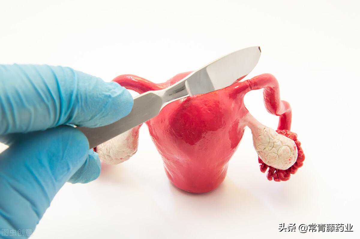 香港验血测DNA权威机构,输卵管堵塞合并输卵管水肿，试管前要切除或是结扎？