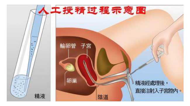 九周还可以香港验血吗,有什么暖宫助孕的方法