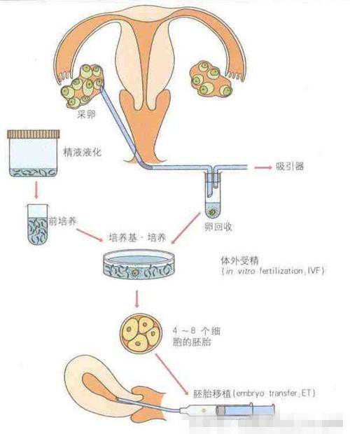 香港的验血男女准不准,一组照片记录试管婴儿孕育全部过程