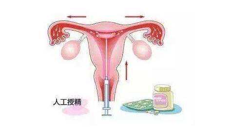香港验血必须7周,助孕不孕不育中的排卵治疗方式