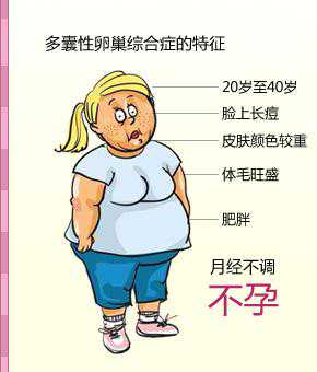 香港验血多少周可以验,备孕妈妈警惕多囊卵巢综合征 会引发妊娠糖尿病、高血
